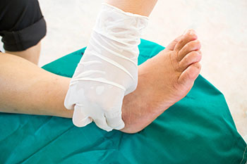Diabetic Ulcers Treatment in the Maricopa County, AZ: Chandler(Dobson Ranch, Kiwanis Park, Tempe, Ocotillo, Sun Lakes, Goodyear Village, Guadalupe, Ahwatukee, Mountain Park Ranch) and Gilbert (The Islands, Val Vista Lakes, Superstition Springs, Reed Park, Power Ranch, Mesa, Queen Creek, Eastmark, Kleinman Park Neighborhood, Lower Santan Village) areas