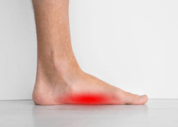 flat feet back pain