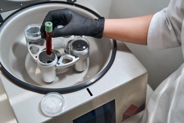 PRP therapy explained